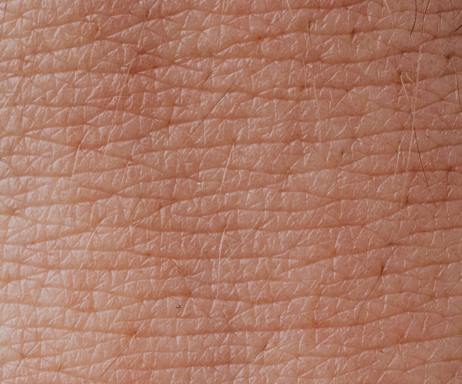 Close up photo of skin